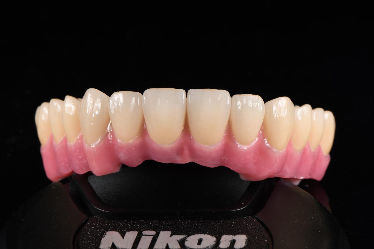How to Choose Zirconia Blocks for Dental Labs